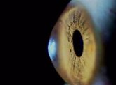 Foto: Crean nuevas técnicas de imagen para el tratamiento a la carta de patologías oculares