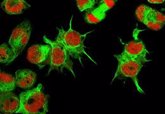 Foto: Halla una proteína que identifica células madre de un tipo de cáncer infantil