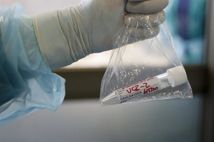 Muestra de un paciente sospechoso de COVID-19