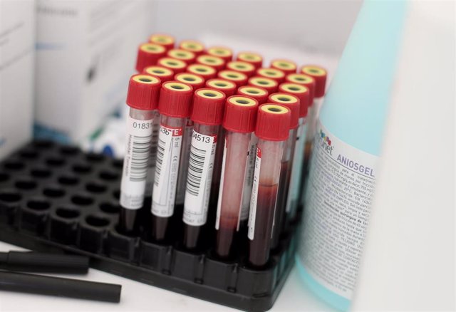 Tubos de ensayo con muestras de pacientes durante la quinta jornada del test serológico masivo de coronavirus que el Ayuntamiento de la localidad madrileña de Torrejón de Ardoz.