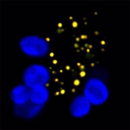 Núcleo de una célula de tabaco, obtenida por microscopía confocal, donde se pueden ver los cuerpos nucleares que contienen el complejo DELLA-COP1 en amarillo. La autofluorescencia de los cloroplastos aparece en azul.
