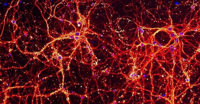 Esta imagen muestra las neuronas y sus conexiones entre sí en rojo y amarillo, y el ADN de la célula en azul. Estas neuronas se usaron para estudiar el impacto de la infección por toxoplasma en las células.