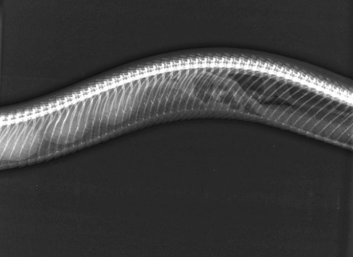 Los tres foliculos localizados.