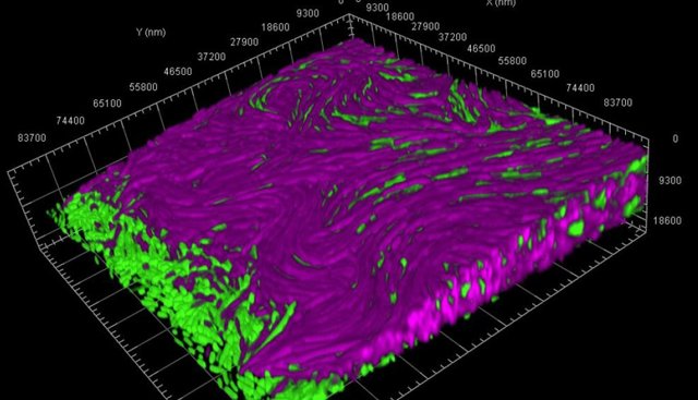 Bacterias perpetran ataques masivos suicidas para defender sus colonias