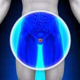 Foto: El 90% de los pacientes con cáncer de próstata se pueden curar si son diagnosticados precozmente
