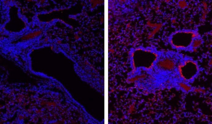 Secciones de tejido de los pulmones de los ratones, después de la infección de la gripe. La imagen de la izquierda es el control y la de la derecha es de ratones sin receptores para el interferón lambda.
