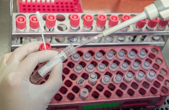Muestras de pruebas de coronavirus