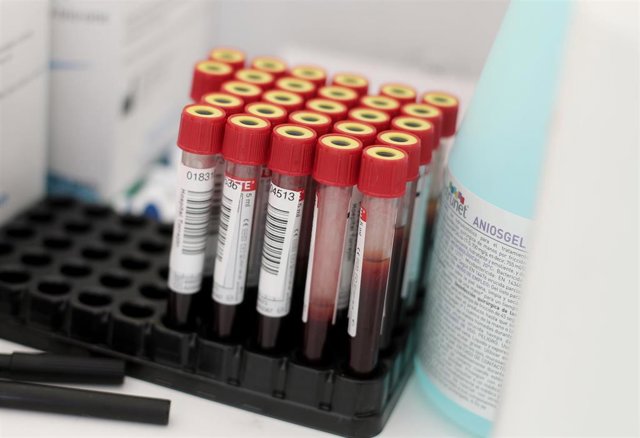 Tubos de ensayo con muestras de pacientes
