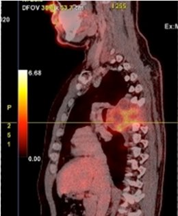 PET del paciente portugués