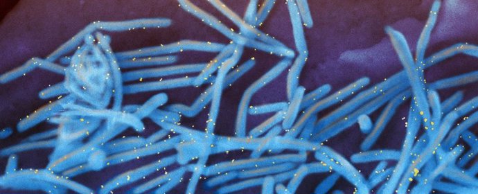 ?Imagen Del Virus Respiratorio Sincitial (Coloreado En Azul) Obtenida Por Microscopía Electrónica (NIAID).