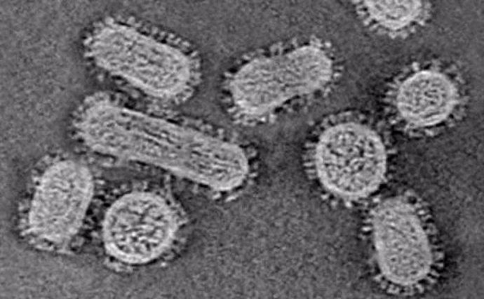Sección de un tomograma de virus de la gripe de la cepa utilizada para el estudio.