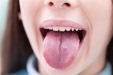 Foto: Los microorganismos en la lengua podrían ayudar a diagnosticar la insuficiencia cardíaca