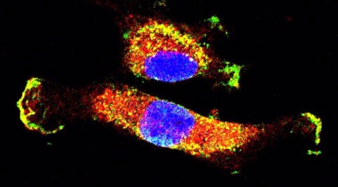Imagen microscópica de dos células en las que un MET mutado relevante para el cáncer ha impulsado la interacción (amarilla) de Rac1 (verde) y mTOR (roja) dentro de las células y en los límites de las mismas. Los núcleos celulares (ADN) están en azul.