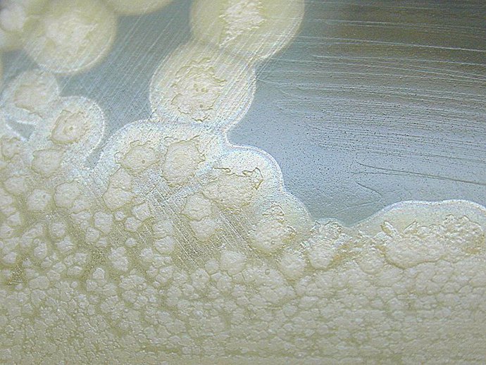 Un estudio descubre cómo las toxinas bacterianas desarrolla la capacidad de caus