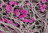 Foto: Investigadores encuentran una nueva función de las plaquetas en los vasos sanguíneos tumorales