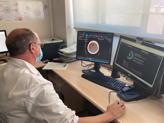 El Hospital Macarena incorpora un software de neuroimagen para mejorar atención al ictus que ofrece el CATI