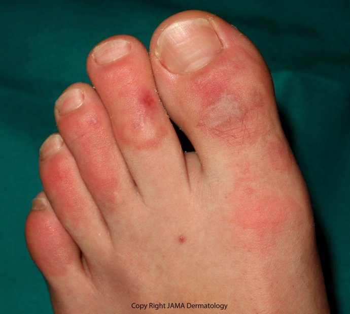 Imagen de las lesiones estudiadas