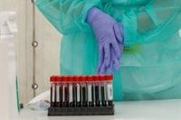 Detectado un brote de COVID-19 con cinco afectados en Palma