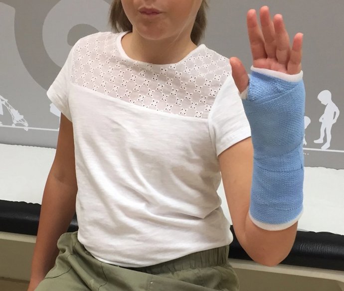 Los traumatismos y las contusiones son unos de los principales motivos de consulta en niños durante el verano