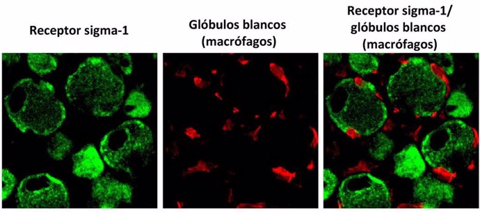 Marcaje inmunohistoquímico de las neuronas sensoriales periféricas que expresan el receptor sigma-1 (en verde), y marcaje de los glóbulos blancos (macrófagos, en rojo), tras la lesión de un nervio en el ratón.