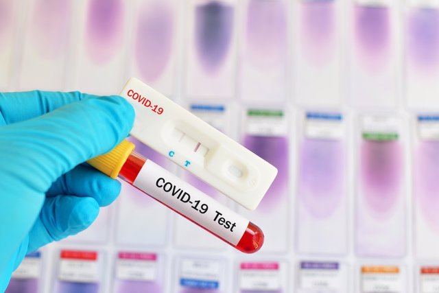 Pruebas del coronavirus, test Covid-19