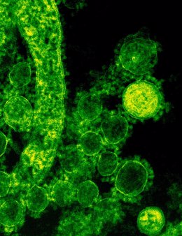Imagen de un virus tomada con microscopio.