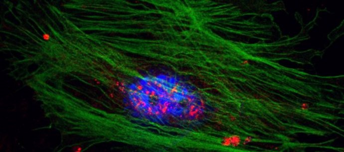 Magen de coinmunofluorescencia para PFKFB3 (rojo) y alfa-actina de músculo liso (verde) en las células estrelladas hepáticas del ratón