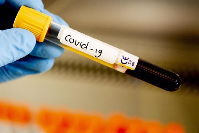 Muestra de coronavirus en el Hospital Amphia de Breda, en Países Bajos