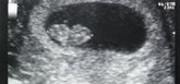 Foto: Documentado un caso del traspaso del coronavirus de una embarazada al feto en el embarazo