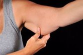 Foto: Qué podemos hacer con la piel colgante de los brazos