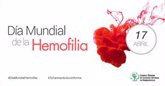 Foto: Nuevas recomendaciones internacionales para la hemofilia A adquirida