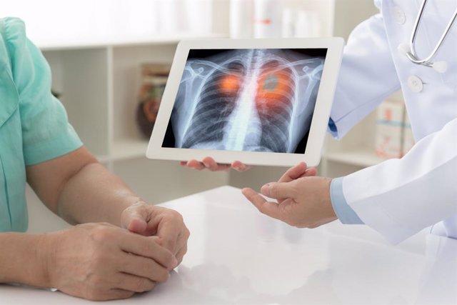 Consulta médica sobre cáncer de pulmón, médico y paciente.
