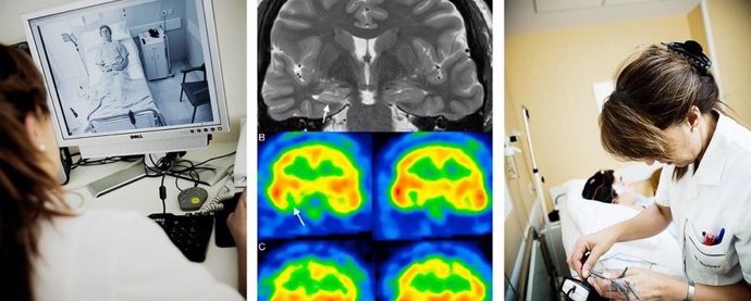 Estudio llevado a cabo por tres neurólogos españoles sobre el riesgo de retirar la medicación en epilepsia.