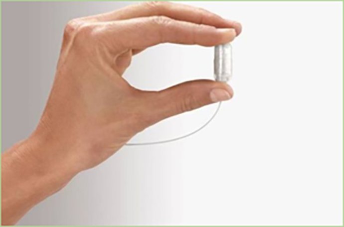 Balón gástrico ingerible