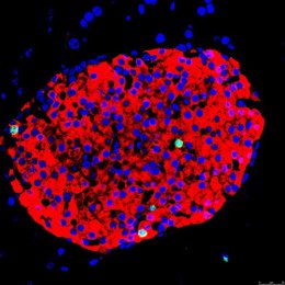 Una instantáneo del estudio que se lleva a cabo.