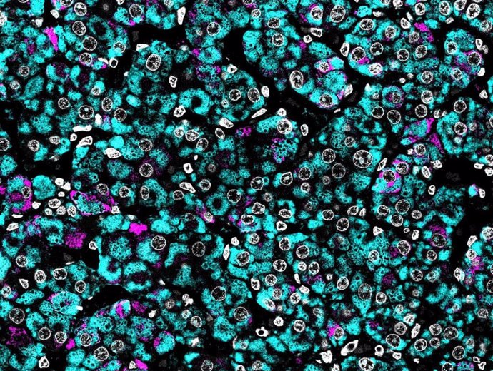 Inmunofluorescencia de una glándula suprarrenal fetal humana que muestra las células esteroidogénicas