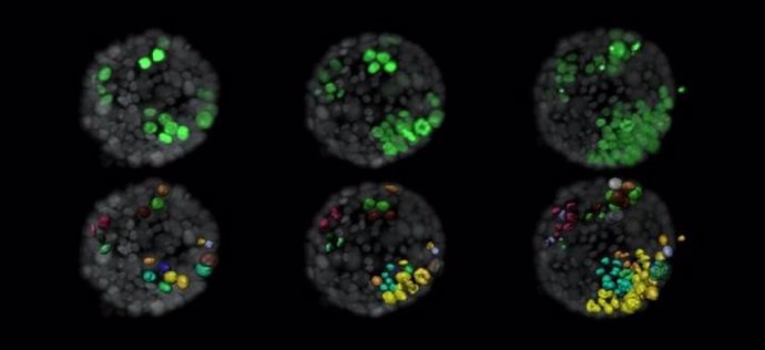 Evolución de las células tumorales (verde) dentro de un organoide normal (gris). El panel inferior muestra la reproducción superficial de las células tumorales y etiqueta las nuevas células que surgen de una sola célula del mismo color.