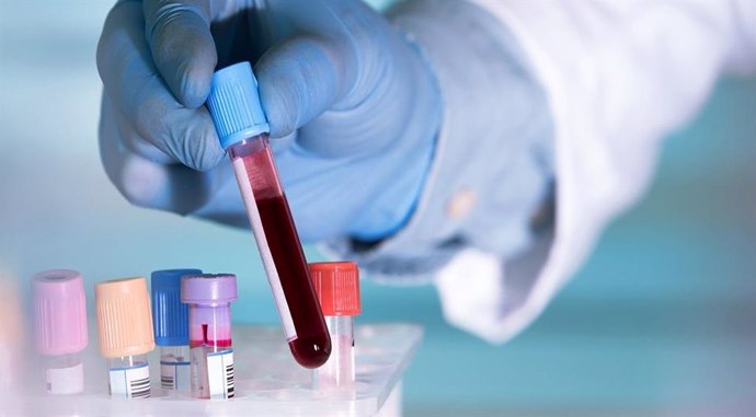 Los investigadores dan un paso significativo hacia un análisis de sangre para di