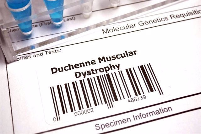 Distrofia muscular de Duchenne.
