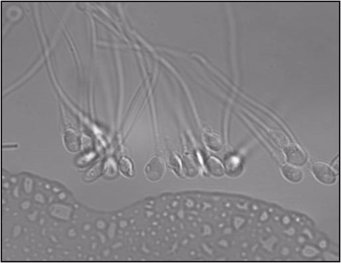 La cola de los espermatozoides se mueve muy rápidamente en 3D, no de lado a lado