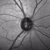 Foto: Unas células madre en el nervio óptico podrían preservar la visión