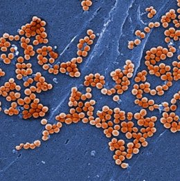 Micrografía electrónica de barrido de  'Staphylococcus aureus' resistente a la meticilina (MRSA) ampliado 2381x.