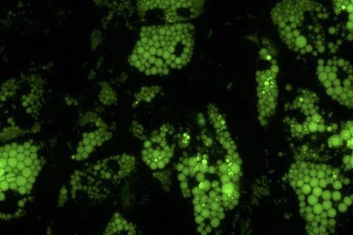Las células grasas marrones sanas (que se muestran en verde) requieren grandes cantidades de una molécula llamada hemo, que permite al cuerpo metabolizar los alimentos adecuadamente.