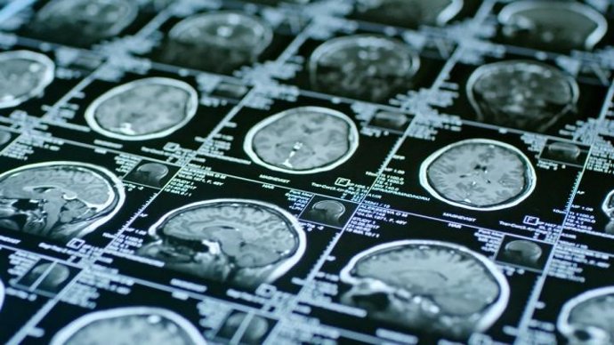 Un nuevo mapa del guardián sensorial del cerebro abre la puerta a nuevos fármaco