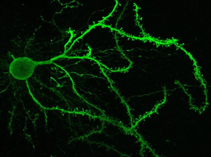 Imagen de una neurona estriatal de la vía directa.