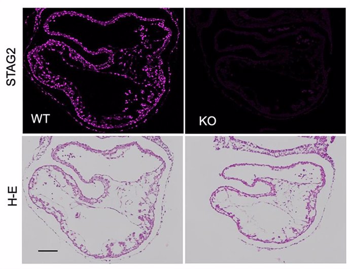 Secciones transversales de embriones murinos normales o sin STAG2 a día 9,5 de gestación teñidas con anticuerpos contra STAG2 (arriba) o hematoxilina-eosina (H-E, abajo) muestran el menor tamaño y una morfología anómala del corazón en ausencia de STAG2
