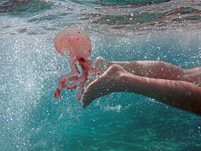 A boy and jellyfish swimming in the sea    Italian boy swimming in the sea accidentally touches a jellyfish