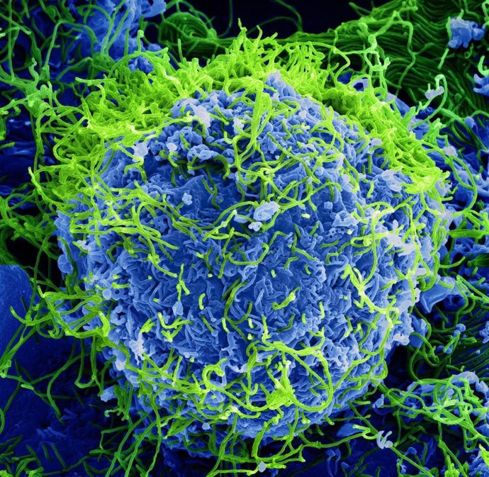 Micrografía electrónica de barrido coloreada de partículas del virus del Ébola (verde) que brotan y se adhieren a la superficie de las células.