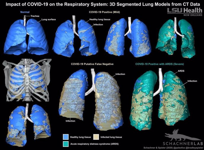 Coronavirus.- Investigadores evidencian que los modelos 3D son útiles para 'ver'