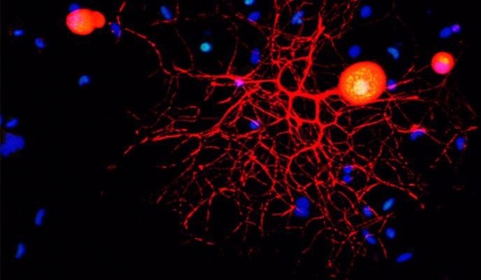 Micrografía confocal de una neurona sensorial periférica en cultivo. Los marcadores y anticuerpos se usan para identificar las neuronas (rojo), la proteína c-Fos (verde) y los núcleos (azul). Nótese la localización nuclear de c-Fos